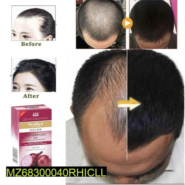 Anti hair loss onion oil 150 ml