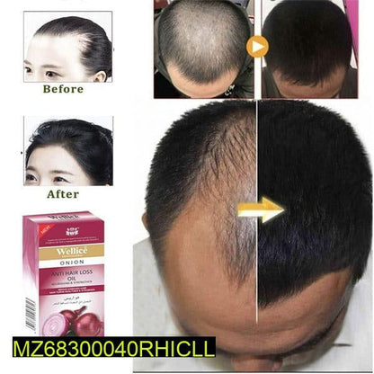 Anti hair loss onion oil 150 ml