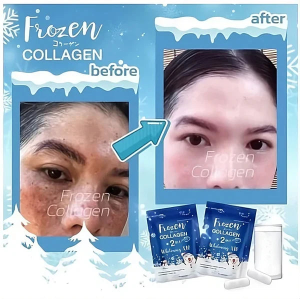 Gluta Frozen 2 in 1